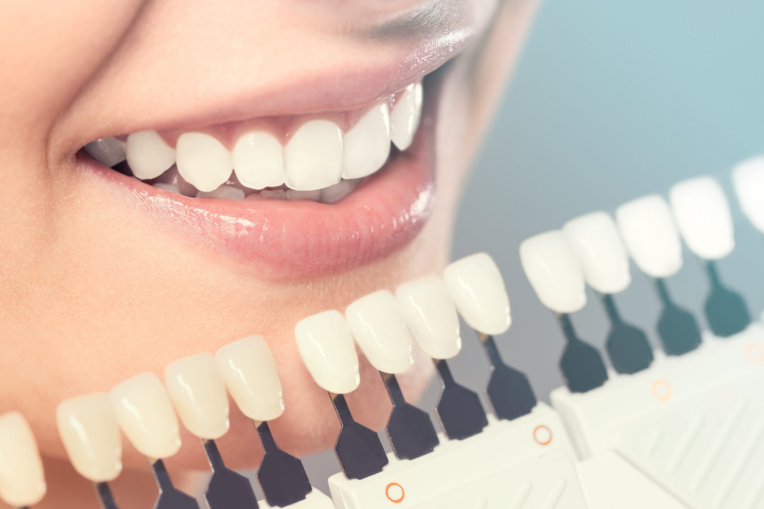 Most Common Cosmetic Dental Procedures and their Significant Benefits