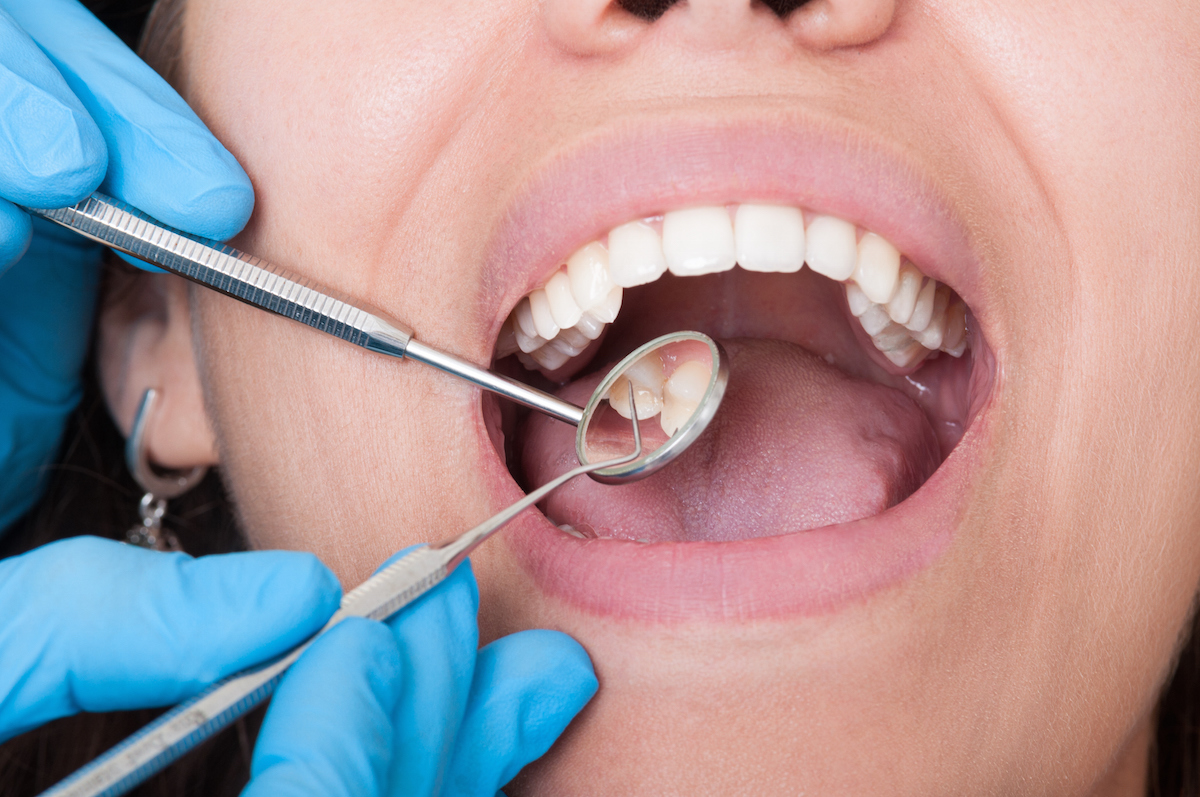 Essential Dental Care Tips to Improve your Oral Hygiene